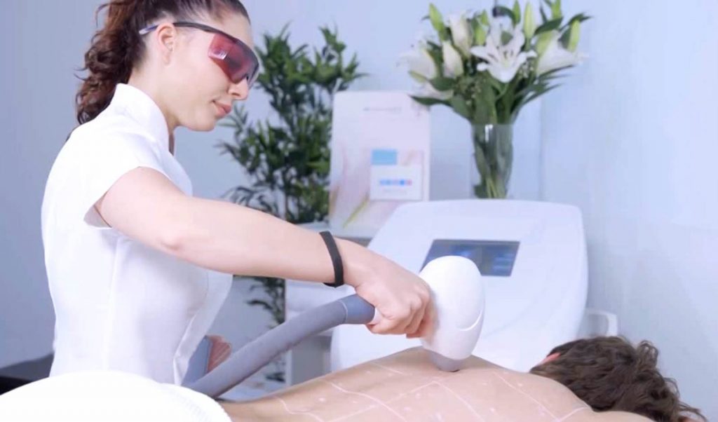 how-long-laser-hair-removal