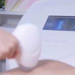 today-laser-technology